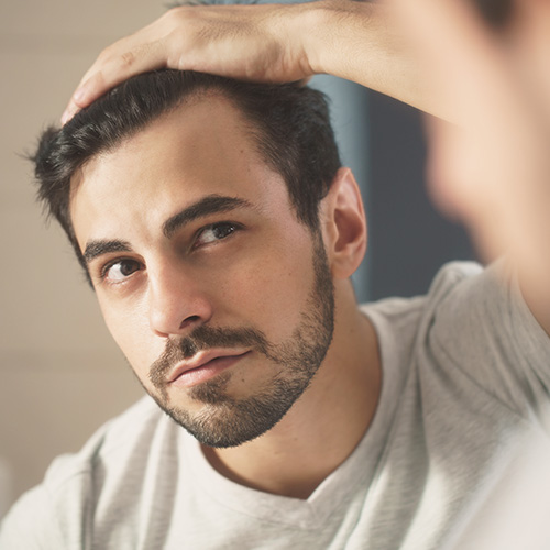 man examinig his hair line in the mirror